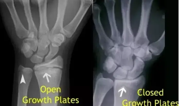 Growth Of Basketball Players